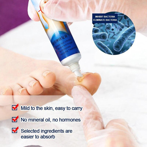 Sumifun Nail Repair Cream – Anti-Fungal Nail Treatment & Damage Repair Formula for Healthy, Clear Nails – alternate view