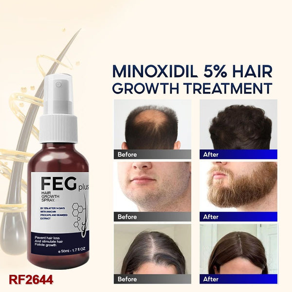 FEG Hair Growth Spray – Natural Anti-Hair Loss & Follicle Stimulating Treatment for Thicker, Fuller Hair (50ml) – alternate view