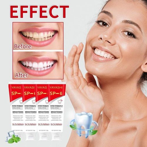 YAYASHI SP-6 Ultra Whitening Toothpaste – Super Probiotic Formula for Stain Removal, Fresh Breath & Bright White Teeth (120g)