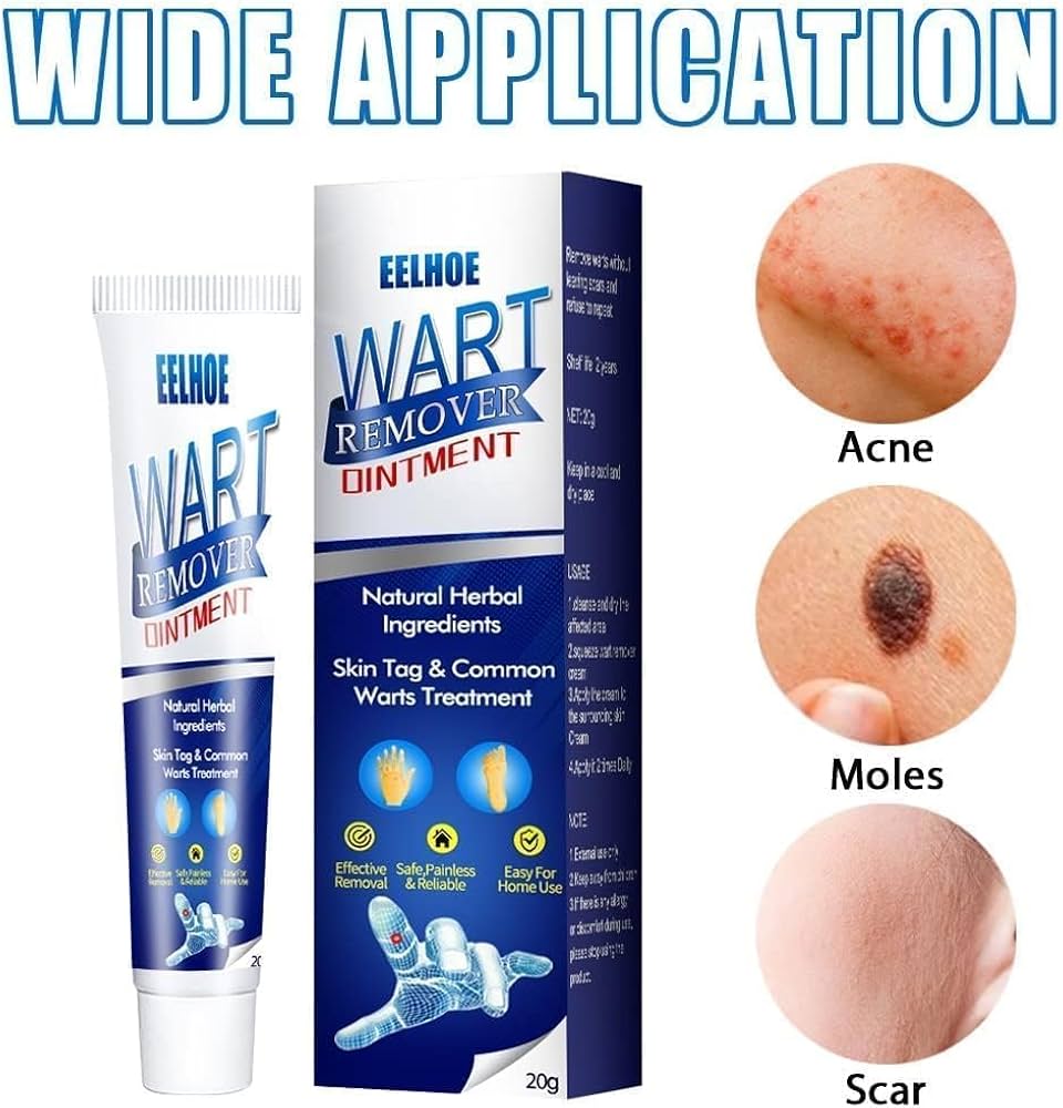 EELHOE Wart Remover Cream – Natural Wart, Corn & Skin Tag Removal Ointment for Clear, Healthy Skin (20g)