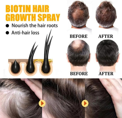 Biotin Hair Growth Serum by EELHOE - Anti-Hair Loss Treatment, Hair Thickening Serum, Strengthening & Revitalizing - 30ml