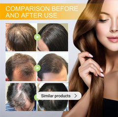 Biotin Hair Growth Serum by EELHOE - Anti-Hair Loss Treatment, Hair Thickening Serum, Strengthening & Revitalizing - 30ml