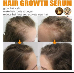 Biotin Hair Growth Serum by EELHOE - Anti-Hair Loss Treatment, Hair Thickening Serum, Strengthening & Revitalizing - 30ml