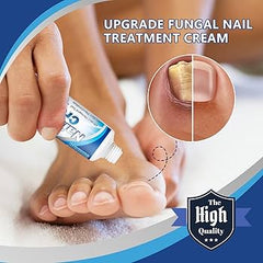 Sumifun Nail Repair Cream – Anti-Fungal Nail Treatment & Damage Repair Formula for Healthy, Clear Nails