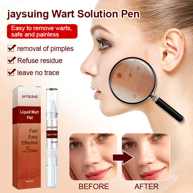 Jaysuing Liquid Wart Flat – Advanced Wart Remover for Face, Hands & Body (20ml)
