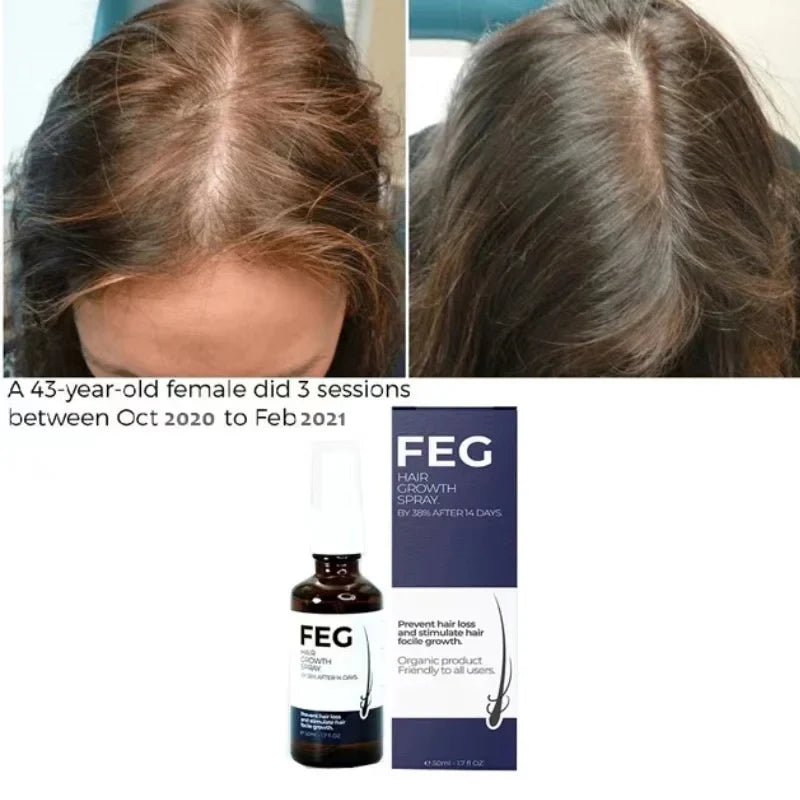 FEG Hair Growth Spray – Natural Anti-Hair Loss & Follicle Stimulating Treatment for Thicker, Fuller Hair (50ml)