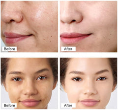 Retinol Face Cream – Whitening, Anti-Wrinkle & Deep Moisturizer for Dry Skin | Skin Firming & Rejuvenation