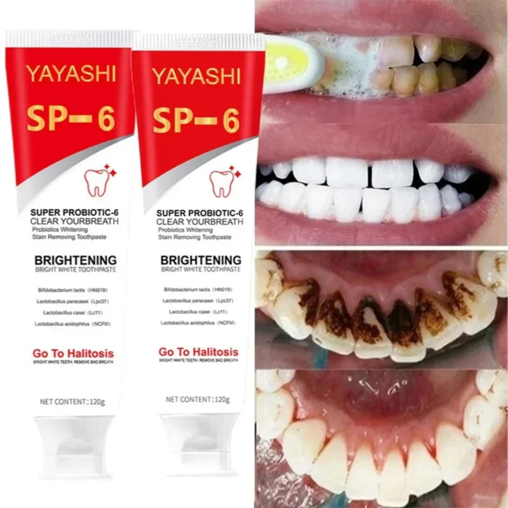 YAYASHI SP-6 Ultra Whitening Toothpaste – Super Probiotic Formula for Stain Removal, Fresh Breath & Bright White Teeth (120g)