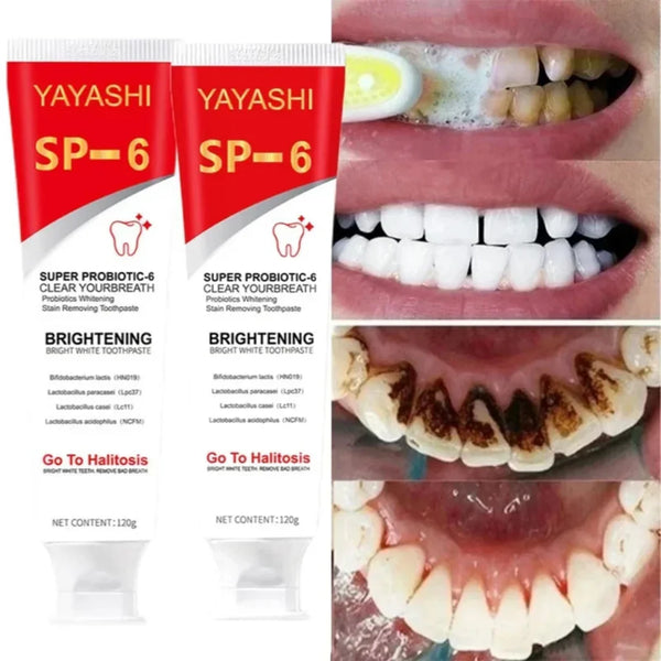 YAYASHI SP-6 Ultra Whitening Toothpaste – Super Probiotic Formula for Stain Removal, Fresh Breath & Bright White Teeth (120g)