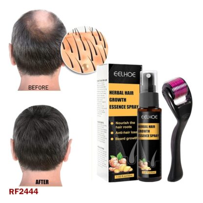 Hair Growth Essence Spray Set – Anti-Hair Loss Spray Oil for Stronger, Thicker, and Healthier Hair (30ml x 2)