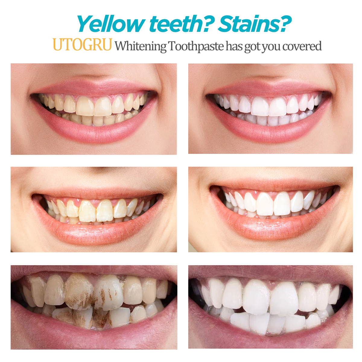 UTOGRU Nicotinamide Whitening Toothpaste – Mint Fresh Breath Toothpaste for Brighter Teeth & Oral Care